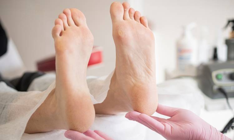 Co na odciski na stopach? Sprawdzone metody usuwania nagniotków i modzeli