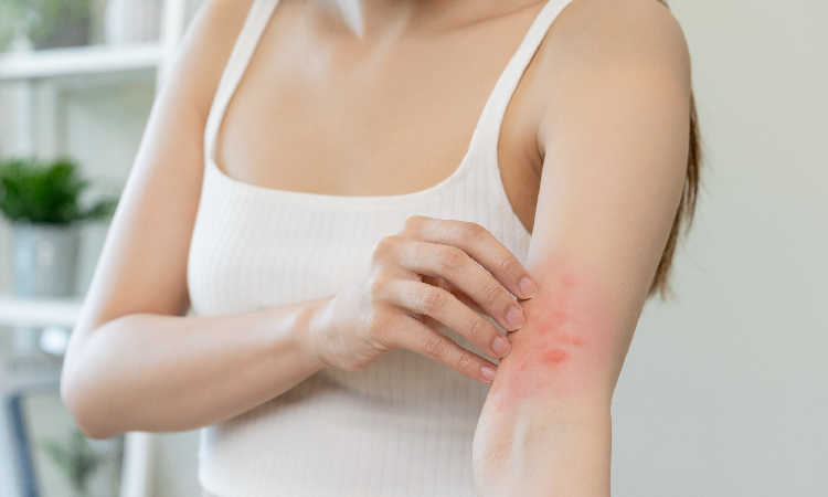 Atopowe zapalenie skóry – kompletny przewodnik po objawach, przyczynach i nowoczesnym leczeniu