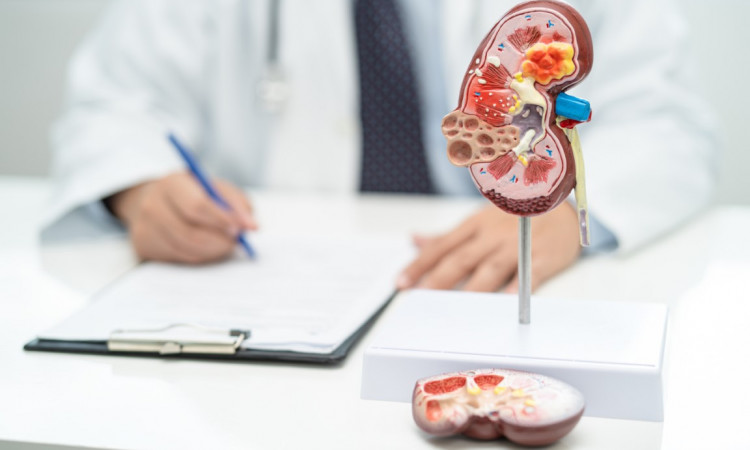 Kamienie nerkowe – jak je zdiagnozować i co zrobić, aby się ich szybko pozbyć?