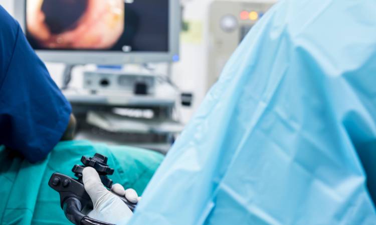 Kolonoskopia - kompleksowy przewodnik po badaniu jelita grubego