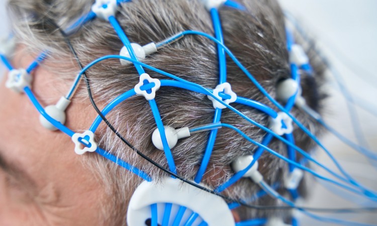 Diagnoza badająca bioelektryczną czynność mózgu: czym jest EEG?