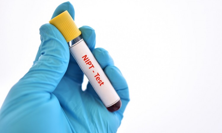 Zespół Patau – objawy i wygląd dzieci z chorobą Patau. Co to jest Trisomia chromosomu 13 i jak można ją wykryć?