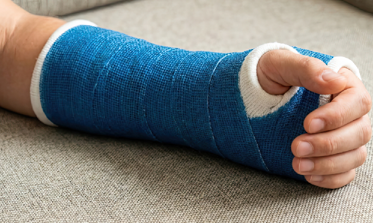 Innowacyjny hydrożel może pomóc w leczeniu złamań. Naukowcy pracują nad nowym rozwiązaniem