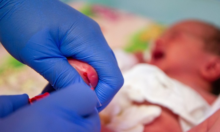 Fenyloketonuria – przyczyny, konsekwencje zdrowotne oraz leczenie genetycznego zaburzenia