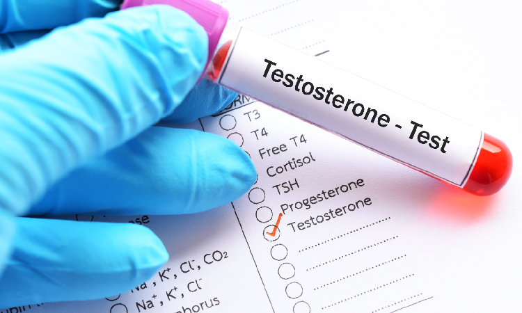 Testosteron – normy, objawy niedoboru. Jak podnieść testosteron?