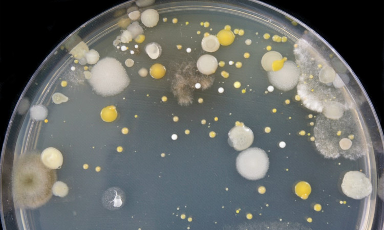 Legionella - objawy, przyczyny i leczenie. Czy legionelloza jest groźna?