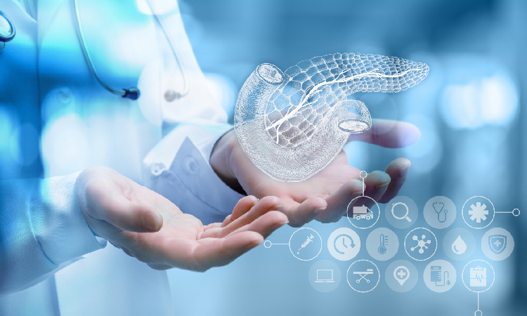 AI wykrywa raka trzustki nawet 3 lata wcześniej. Nowe możliwości diagnostyki